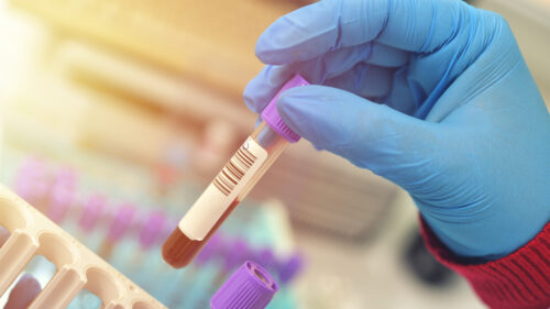 Laboratori Analisi